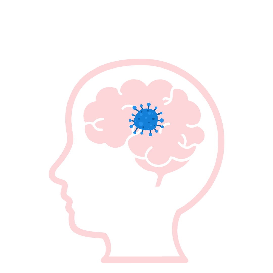 Patient with glioblastoma